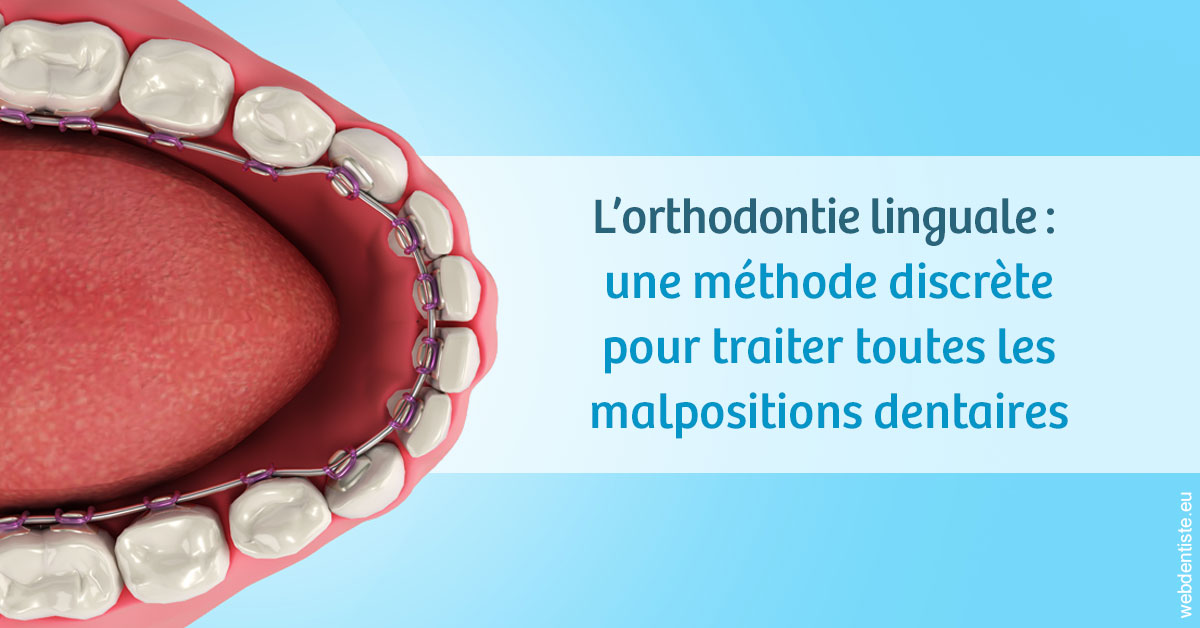 https://dr-lugon-emeric.chirurgiens-dentistes.fr/L'orthodontie linguale 1