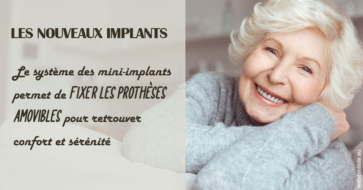https://dr-lugon-emeric.chirurgiens-dentistes.fr/Les nouveaux implants 1