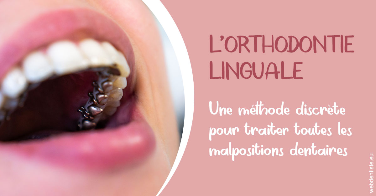 https://dr-lugon-emeric.chirurgiens-dentistes.fr/L'orthodontie linguale 2