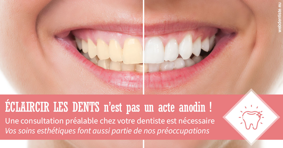 https://dr-lugon-emeric.chirurgiens-dentistes.fr/Eclaircir les dents 1