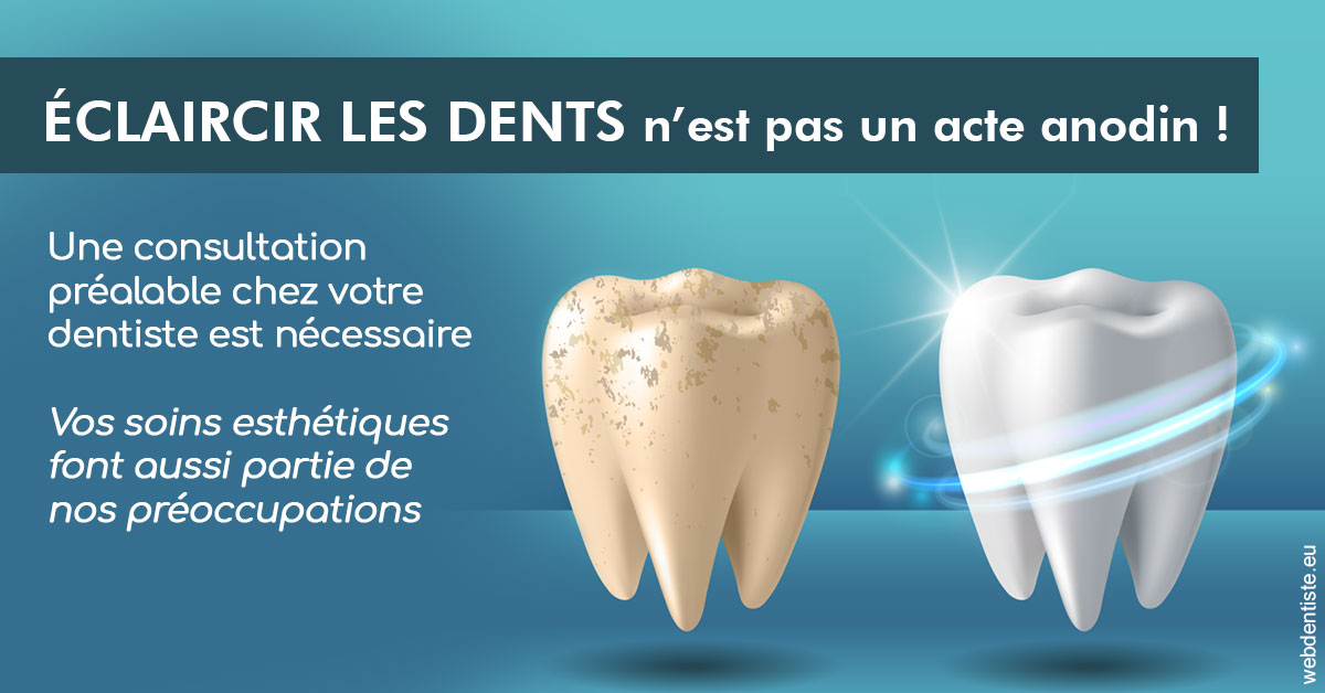 https://dr-lugon-emeric.chirurgiens-dentistes.fr/Eclaircir les dents 2