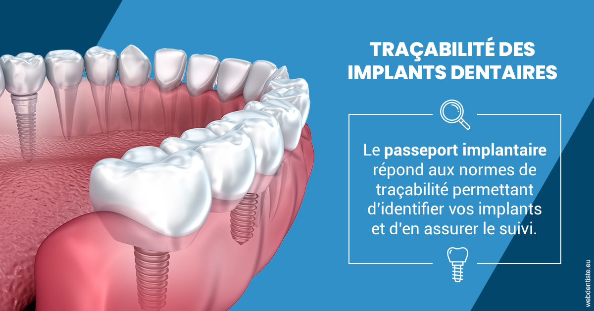 https://dr-lugon-emeric.chirurgiens-dentistes.fr/T2 2023 - Traçabilité des implants 1