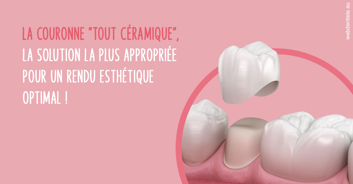 https://dr-lugon-emeric.chirurgiens-dentistes.fr/La couronne "tout céramique"
