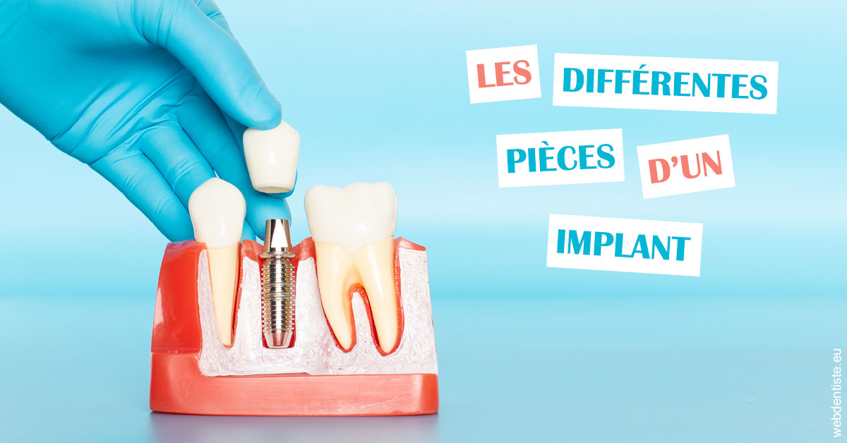 https://dr-lugon-emeric.chirurgiens-dentistes.fr/Les différentes pièces d’un implant 2