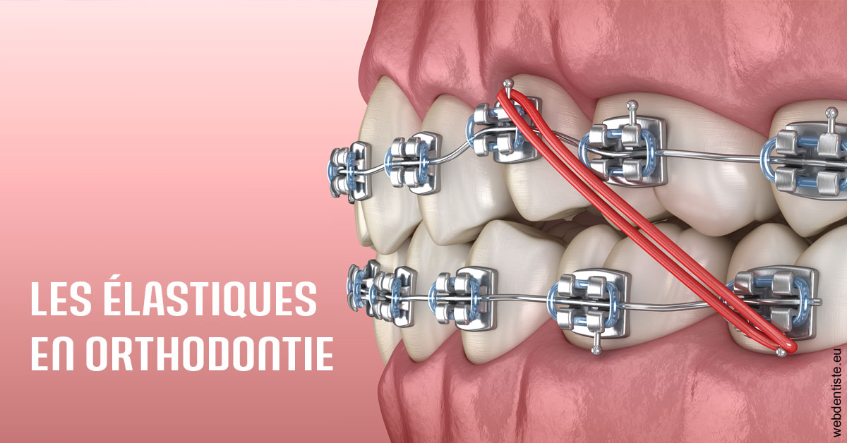 https://dr-lugon-emeric.chirurgiens-dentistes.fr/Elastiques orthodontie 2