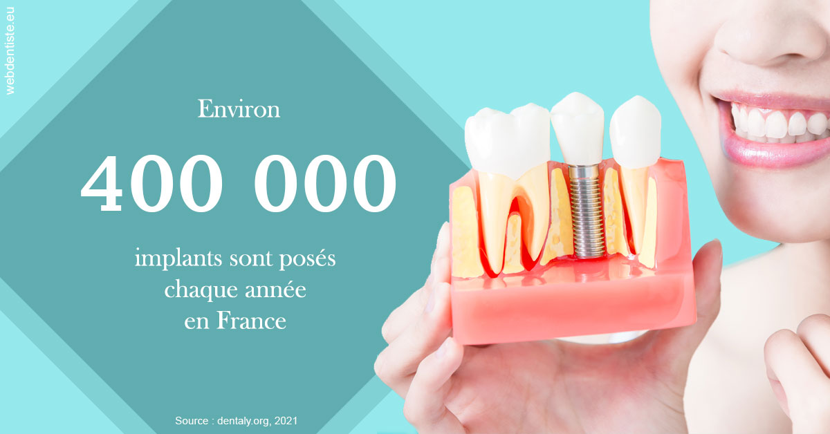 https://dr-lugon-emeric.chirurgiens-dentistes.fr/Pose d'implants en France 2